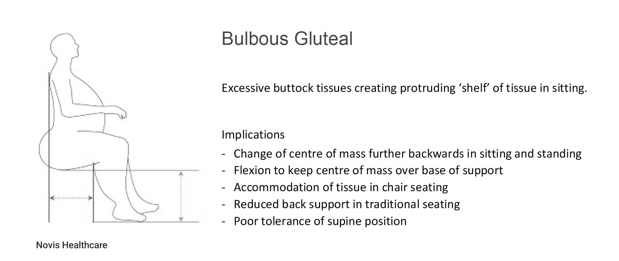 Bulbous-Gluteal-Image-for-EIM-Blog-Post.jpg Bulbous-Gluteal-Image-for-EIM-Blog-Post.jpg