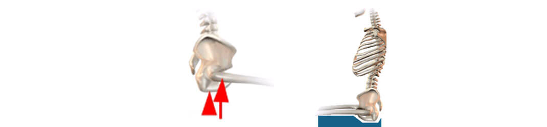 Anatomical illustration of a seat cushion pelvic loading area