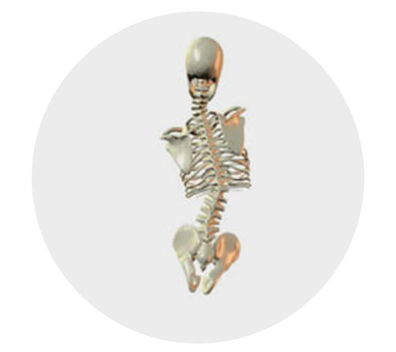 Pelvic Obliquity and Scoliosis